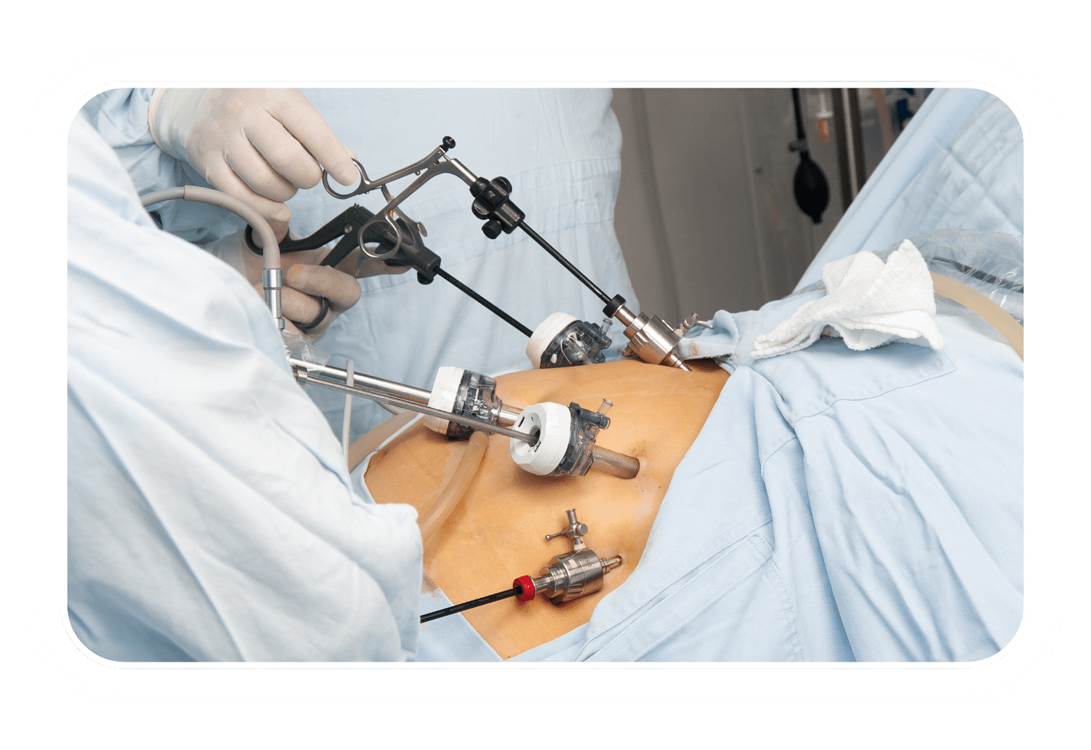 Bariatric Surgery Brampton Weight Loss Surgery in Brampton Cost